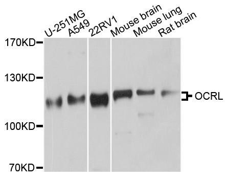 OCRL Antibody - Western blot analysis of extracts of various cell lines.