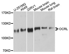 OCRL Antibody - Western blot analysis of extracts of various cell lines.