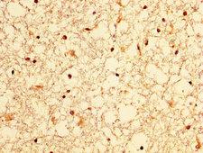 OCRL Antibody - Immunohistochemistry image at a dilution of 1:300 and staining in paraffin-embedded human brain tissue performed on a Leica BondTM system. After dewaxing and hydration, antigen retrieval was mediated by high pressure in a citrate buffer (pH 6.0) . Section was blocked with 10% normal goat serum 30min at RT. Then primary antibody (1% BSA) was incubated at 4 °C overnight. The primary is detected by a biotinylated secondary antibody and visualized using an HRP conjugated SP system.
