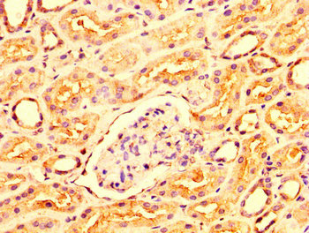 OCRL Antibody - Immunohistochemistry image at a dilution of 1:300 and staining in paraffin-embedded human kidney tissue performed on a Leica BondTM system. After dewaxing and hydration, antigen retrieval was mediated by high pressure in a citrate buffer (pH 6.0) . Section was blocked with 10% normal goat serum 30min at RT. Then primary antibody (1% BSA) was incubated at 4 °C overnight. The primary is detected by a biotinylated secondary antibody and visualized using an HRP conjugated SP system.