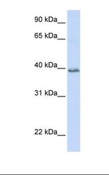 OCSP / TSPAN10 Antibody - Fetal heart lysate. Antibody concentration: 1.0 ug/ml. Gel concentration: 12%.  This image was taken for the unconjugated form of this product. Other forms have not been tested.