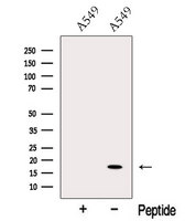 ODAM Antibody - Western blot analysis of extracts of A549 cells using ODAM antibody. The lane on the left was treated with blocking peptide.