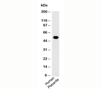 ODC1 / Ornithine Decarboxylase Antibody - ODC-1 antibody ODC1/485 western blot.  This image was taken for the unmodified form of this product. Other forms have not been tested.