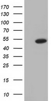 ODC1 / Ornithine Decarboxylase Antibody - HEK293T cells were transfected with the pCMV6-ENTRY control (Left lane) or pCMV6-ENTRY ODC1 (Right lane) cDNA for 48 hrs and lysed. Equivalent amounts of cell lysates (5 ug per lane) were separated by SDS-PAGE and immunoblotted with anti-ODC1.