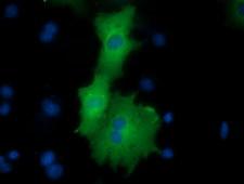 ODC1 / Ornithine Decarboxylase Antibody - Anti-ODC1 mouse monoclonal antibody  immunofluorescent staining of COS7 cells transiently transfected by pCMV6-ENTRY ODC1.