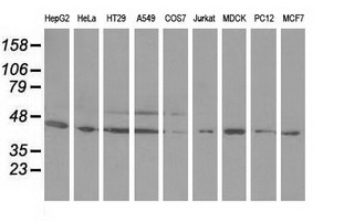 ODC1 / Ornithine Decarboxylase Antibody - Western blot of extracts (35 ug) from 9 different cell lines by using anti-ODC1 monoclonal antibody.