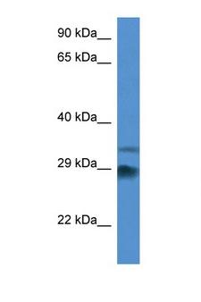 ODF1 Antibody - ODF1 / SODF antibody Western blot of Mouse Heart lysate. Antibody concentration 1 ug/ml. This image was taken for the unconjugated form of this product. Other forms have not been tested.