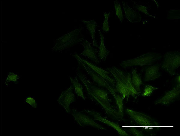 ODF2 Antibody - Immunofluorescence of monoclonal antibody to ODF2 on HeLa cell . [antibody concentration 10 ug/ml]