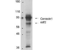 ODF2 Antibody - Anti-Cenexin-1 in Western blot of Protein A Purified Anti-Cenexin-1 antibody shows detection of Cenexin-1 in total cell lysates from mouse F9 embryonic carcinoma cells. Arrowheads show detection of Cenexin-1 at approximately 93kDa and Outer dense fiber protein 2 (ODF2) at approximately 70kDa. In personal communication with K. Lee, CCR-NCI, Bethesda, MD.