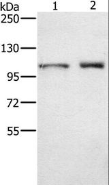 ODF2 Antibody - Western blot analysis of Human testis tissue and K562 cell, using ODF2 Polyclonal Antibody at dilution of 1:650.