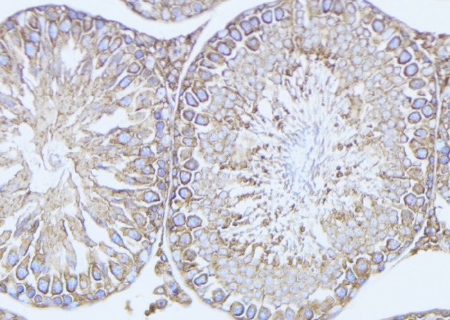 ODF2 Antibody - 1:100 staining mouse testis tissue by IHC-P. The sample was formaldehyde fixed and a heat mediated antigen retrieval step in citrate buffer was performed. The sample was then blocked and incubated with the antibody for 1.5 hours at 22°C. An HRP conjugated goat anti-rabbit antibody was used as the secondary.