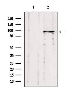 ODF2 Antibody - Western blot analysis of extracts of HepG2 cells using ODF2 antibody. Lane 1 was treated with the blocking peptide.