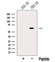 ODF2L Antibody - Western blot analysis of extracts of HEK293 cells using ODF2L antibody. The lane on the left was treated with blocking peptide.