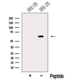 ODF2L Antibody - Western blot analysis of extracts of HEK293 cells using ODF2L antibody. The lane on the left was treated with blocking peptide.