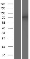 ODF2L Protein - Western validation with an anti-DDK antibody * L: Control HEK293 lysate R: Over-expression lysate
