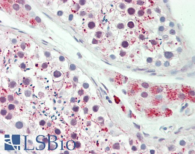 ODF3 Antibody - Anti-ODF3 antibody IHC staining of human testis. Immunohistochemistry of formalin-fixed, paraffin-embedded tissue after heat-induced antigen retrieval. Antibody concentration 10 ug/ml.  This image was taken for the unconjugated form of this product. Other forms have not been tested.