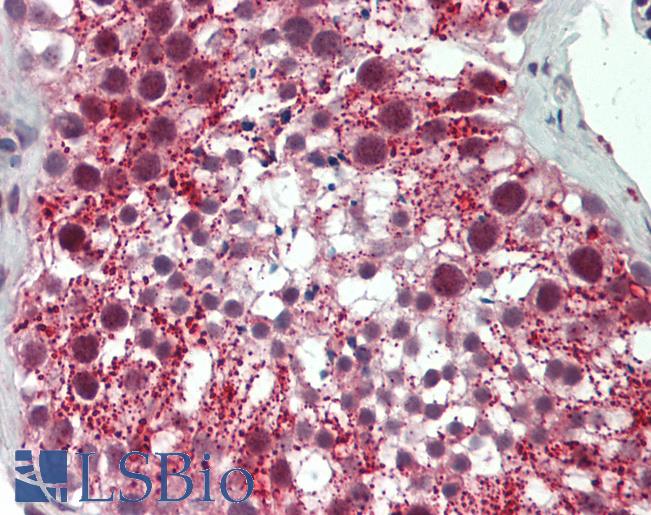 ODF3 Antibody - Human Testis: Formalin-Fixed, Paraffin-Embedded (FFPE).  This image was taken for the unconjugated form of this product. Other forms have not been tested.