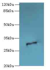 ODF3L1 Antibody - Western blot. All lanes: ODF3L1 antibody at 3 ug/ml+HT0- whole cell lysate Goat polyclonal to rabbit at 1:10000 dilution. Predicted band size: 31 kDa. Observed band size: 31 kDa.
