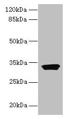 ODF3L1 Antibody - Western blot All lanes: ODF3L1 antibody at 3µg/ml + HT29 whole cell lysate Secondary Goat polyclonal to rabbit IgG at 1/10000 dilution Predicted band size: 31 kDa Observed band size: 31 kDa