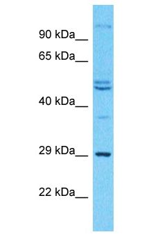 ODF3L2 Antibody - ODF3L2 antibody Western Blot of 786-0. Antibody dilution: 1 ug/ml.  This image was taken for the unconjugated form of this product. Other forms have not been tested.