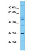 ODF3L2 Antibody - ODF3L2 antibody Western Blot of 786-0. Antibody dilution: 1 ug/ml.  This image was taken for the unconjugated form of this product. Other forms have not been tested.