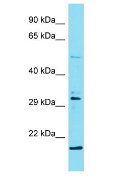 ODF3L2 Antibody - ODF3L2 antibody Western Blot of MCF7. Antibody dilution: 1 ug/ml.  This image was taken for the unconjugated form of this product. Other forms have not been tested.