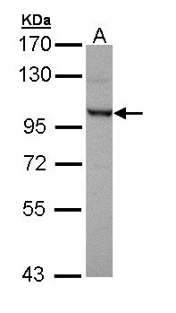 OFD1 Antibody - Sample (30 ug of whole cell lysate). A: Molt-4 . 7.5% SDS PAGE. OFD1 antibody diluted at 1:5000