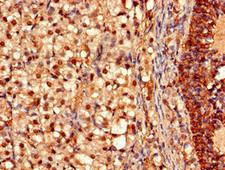 OFD1 Antibody - Immunohistochemistry of paraffin-embedded human adrenal gland tissue using OFD1 Antibody at dilution of 1:100