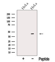 OFD1 Antibody - Western blot analysis of extracts of HeLa cells using OFD1 antibody. The lane on the left was treated with blocking peptide.
