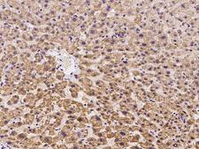 OFD1 Antibody - Immunochemical staining of human OFD1 in human liver with rabbit polyclonal antibody at 1:300 dilution, formalin-fixed paraffin embedded sections.