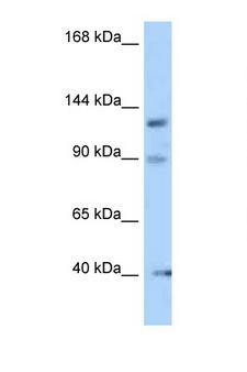 OFD1 Antibody - OFD1 antibody Western blot of Rat Liver lysate. Antibody concentration 1 ug/ml.  This image was taken for the unconjugated form of this product. Other forms have not been tested.