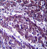 OGDH Antibody - OGDH Antibody immunohistochemistry of formalin-fixed and paraffin-embedded human heart tissue followed by peroxidase-conjugated secondary antibody and DAB staining.