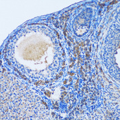 OGDH Antibody - Immunohistochemistry of paraffin-embedded rat ovary tissue.