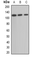 OGDH Antibody - Western blot analysis of OGDH expression in mouse heart (A); mouse brain (B); rat kidney (C) whole cell lysates.