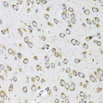 OGDH Antibody - Immunohistochemistry of paraffin-embedded mouse brain using OGDH antibody at dilution of 1:100 (40x lens).