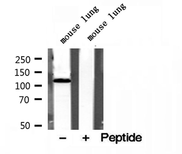OGDH Antibody - Western blot analysis of extracts of mouse lung tissue using OGDH antibody.