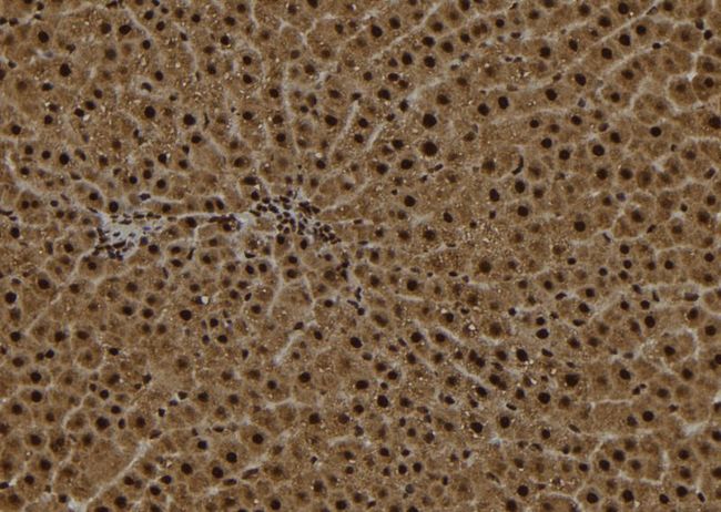 OGDH Antibody - 1:100 staining rat liver tissue by IHC-P. The sample was formaldehyde fixed and a heat mediated antigen retrieval step in citrate buffer was performed. The sample was then blocked and incubated with the antibody for 1.5 hours at 22°C. An HRP conjugated goat anti-rabbit antibody was used as the secondary.