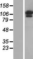 OGDH Protein - Western validation with an anti-DDK antibody * L: Control HEK293 lysate R: Over-expression lysate
