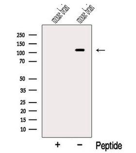 OGDHL Antibody - Western blot analysis of extracts of mouse brain tissue using OGDHL antibody. The lane on the left was treated with blocking peptide.