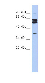 OGFOD1 Antibody - OGFOD1 antibody Western blot of DU145 cell lysate. This image was taken for the unconjugated form of this product. Other forms have not been tested.