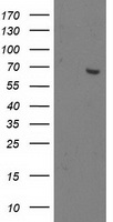 OGFOD1 Antibody - HEK293T cells were transfected with the pCMV6-ENTRY control (Left lane) or pCMV6-ENTRY OGFOD1 (Right lane) cDNA for 48 hrs and lysed. Equivalent amounts of cell lysates (5 ug per lane) were separated by SDS-PAGE and immunoblotted with anti-OGFOD1.