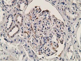OGFOD1 Antibody - IHC of paraffin-embedded Human Kidney tissue using anti-OGFOD1 mouse monoclonal antibody.
