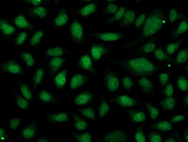 OGFOD1 Antibody - Immunofluorescent staining of HeLa cells using anti-OGFOD1 mouse monoclonal antibody.