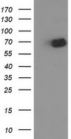 OGFOD1 Antibody - HEK293T cells were transfected with the pCMV6-ENTRY control (Left lane) or pCMV6-ENTRY OGFOD1 (Right lane) cDNA for 48 hrs and lysed. Equivalent amounts of cell lysates (5 ug per lane) were separated by SDS-PAGE and immunoblotted with anti-OGFOD1.