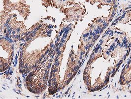OGFOD1 Antibody - IHC of paraffin-embedded Human prostate tissue using anti-OGFOD1 mouse monoclonal antibody. (Heat-induced epitope retrieval by 10mM citric buffer, pH6.0, 100C for 10min).