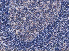 OGFOD1 Antibody - IHC of paraffin-embedded Human lymph node tissue using anti-OGFOD1 mouse monoclonal antibody. (Heat-induced epitope retrieval by 10mM citric buffer, pH6.0, 100C for 10min).