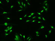 OGFOD1 Antibody - Immunofluorescence staining of OGFOD1 in U251MG cells. Cells were fixed with 4% PFA, permeabilzed with 0.1% Triton X-100 in PBS, blocked with 10% serum, and incubated with rabbit anti-Human OGFOD1 polyclonal antibody (dilution ratio 1:200) at 4°C overnight. Then cells were stained with the Alexa Fluor 488-conjugated Goat Anti-rabbit IgG secondary antibody (green). Positive staining was localized to Nucleus.