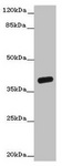 OGFOD2 Antibody - Western blot All lanes: OGFOD2 antibody at 3µg/ml + Mouse liver tissue Secondary Goat polyclonal to rabbit IgG at 1/10000 dilution Predicted band size: 39, 33, 15, 21 kDa Observed band size: 39 kDa