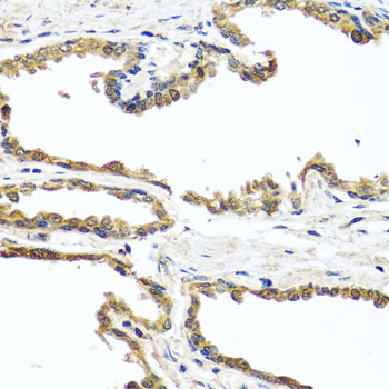 OGFR Antibody - Immunohistochemistry of paraffin-embedded human prostate.
