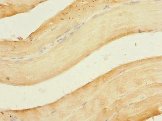 OGFR Antibody - Immunohistochemistry of paraffin-embedded human skeletal muscle tissue at dilution 1:100